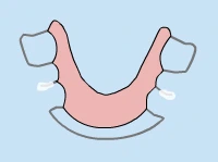 Cartoon smile with braces on upper and lower teeth against blue background.